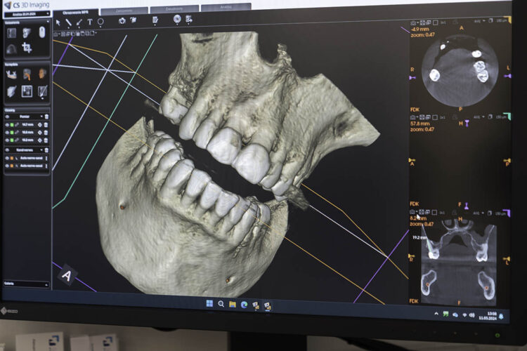tomografia stomatologiczna Poznań