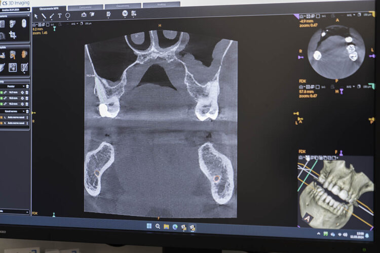 tomografia dentystyczna